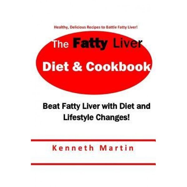 The Fatty Liver Diet & Cookbook: Beat Fatty Liver with Diet & Lifestyle Changes, Kenneth Martin (Author)