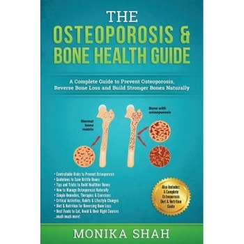Osteoporosis: The Osteoporosis & Bone Health Guide: A Complete Guide to Prevent Osteoporosis, Reverse Bone Loss and Build Stronger B, Monika Shah (Author) Osteoporosis: The Osteoporosis & Bone Health Guide: A Complete Guide to Prevent Osteoporosis, Reverse Bone Loss and Build Stronger B, Monika Shah (Author)