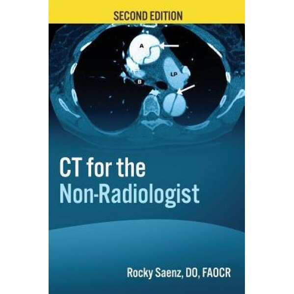 CT for the Non-Radiologist: The Essential CT Study Guide - Rocky Saenz (Author)