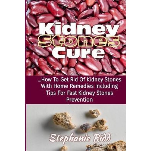 Kidney Stones Cure: How to Get Rid of Kidney Stones with Home Remedies Including the Tips for Kidney Stones Prevention and Treatment!, Stephanie Ridd (Author)