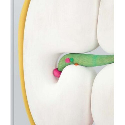 Matthew Ronay, Matthew Ronay (Artist)