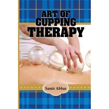 Art of Cupping Therapy, Samir Ali Abbas (Author) Art of Cupping Therapy, Samir Ali Abbas (Author)