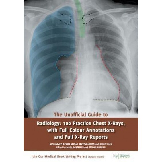 The Unofficial Guide to Radiology: 100 Practice Chest X Rays with Full Colour Annotations and Full X Ray Reports - Nihad Khan (Editor)