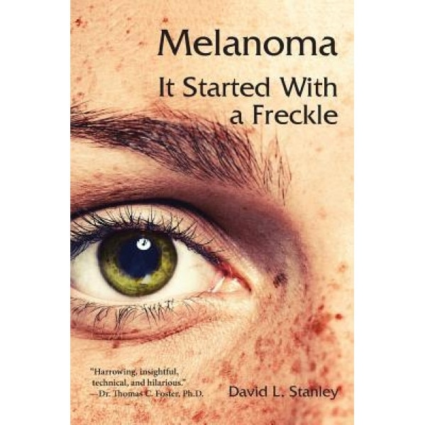 Melanoma: It Started with a Freckle, David L. Stanley (Author)