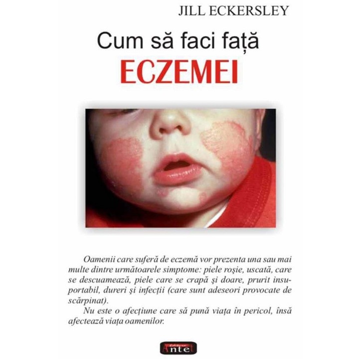 Cum Sa Faci Fata Eczemei - Jill Eckersley
