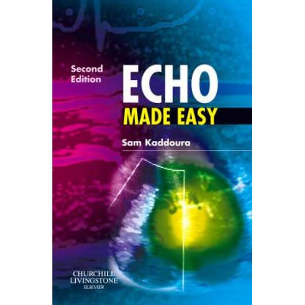 Echo Made Easy
