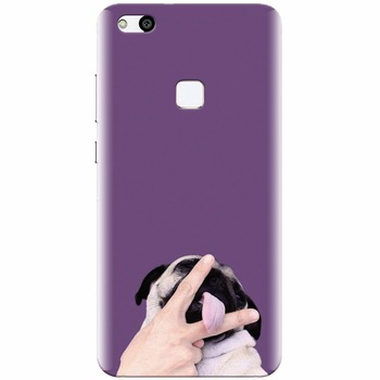 Husa silicon pentru Huawei P10 Lite, Cute Dog 2 Husa silicon pentru Huawei P10 Lite, Cute Dog 2