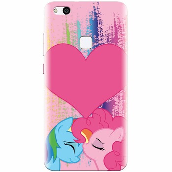 Husa silicon pentru Huawei P10 Lite, Pinkie Kiss Husa silicon pentru Huawei P10 Lite, Pinkie Kiss