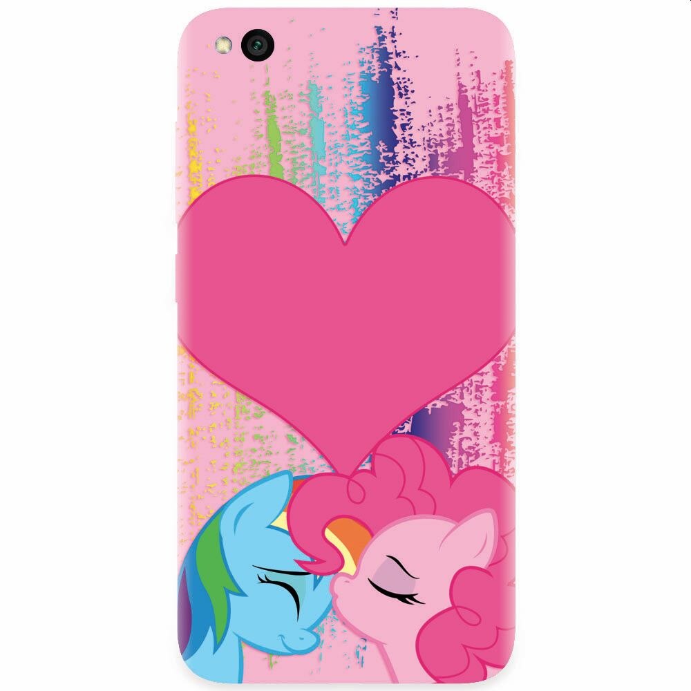 Husa silicon pentru Xiaomi Redmi Go, Pinkie Kiss