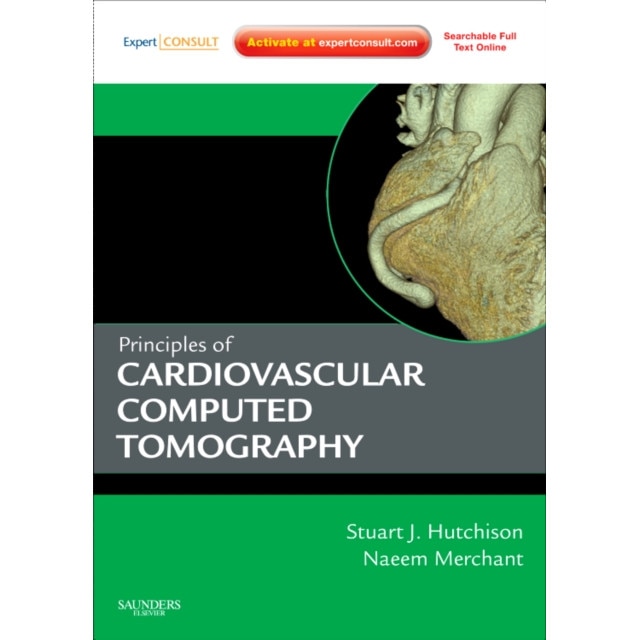 Principles of Cardiac and Vascular Computed Tomography de Stuart J. Hutchison