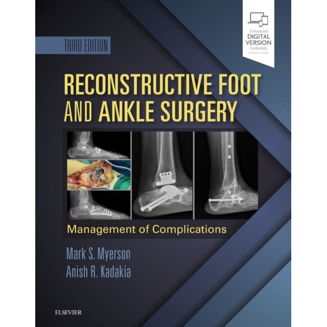 Reconstructive Foot and Ankle Surgery: Management of Complications de Mark S. Myerson