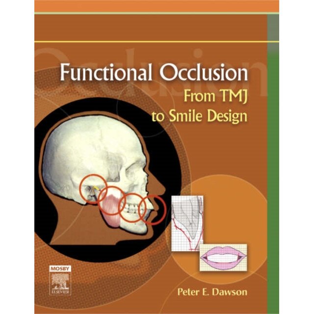 Functional Occlusion de Peter E. Dawson