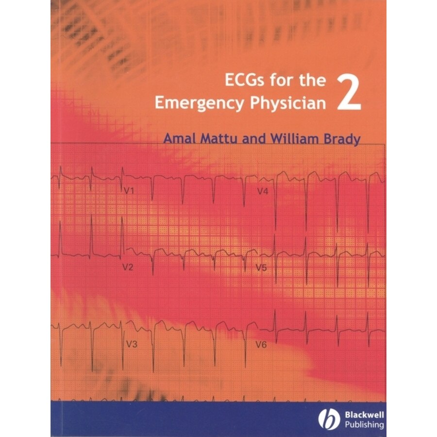 ECGs for the Emergency Physician 2 de Amal Mattu
