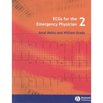 ECGs for the Emergency Physician 2 de Amal Mattu ECGs for the Emergency Physician 2 de Amal Mattu