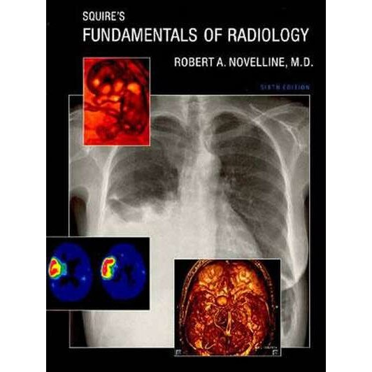 Squire's Fundamentals of Radiology (6th edition) de Robert A Novelline