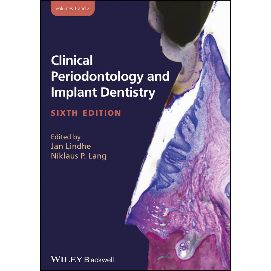 Clinical Periodontology and Implant Dentistry, 2 Volume Set de Niklaus P. Lang