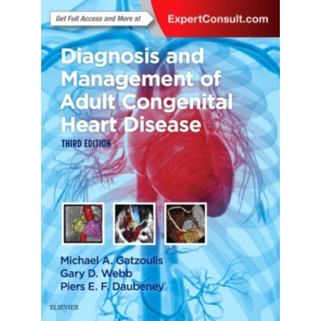 Diagnosis and Management of Adult Congenital Heart Disease de Michael A. Gatzoulis