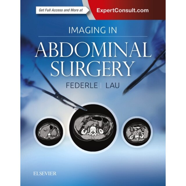 Imaging in Abdominal Surgery de Michael P. Federle