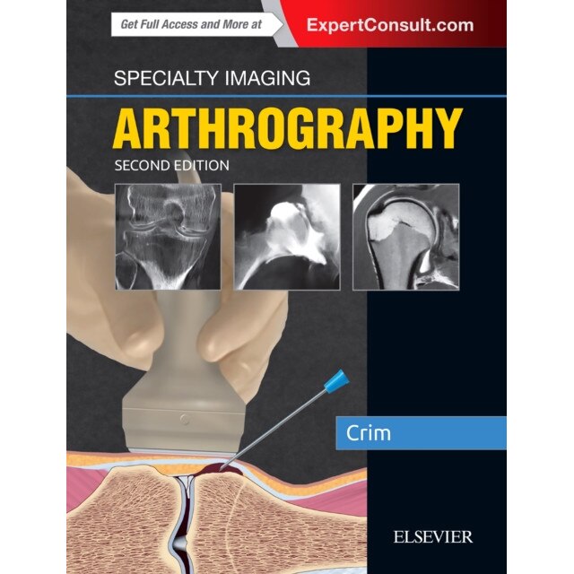 Specialty Imaging: Arthrography de Julia R. Crim