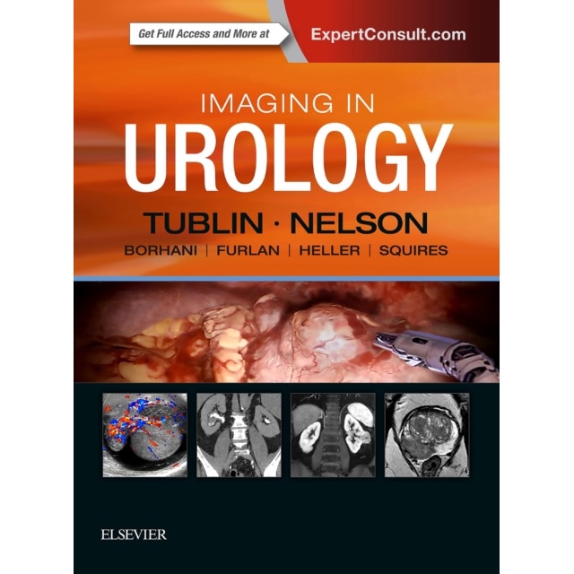 Imaging in Urology de Mitchell E. Tublin