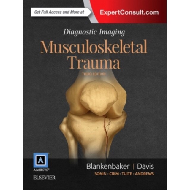 Diagnostic Imaging: Musculoskeletal Trauma de Donna G Blankenbaker