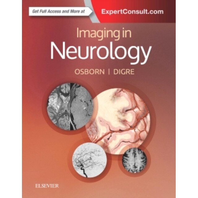 Imaging in Neurology de Anne G. Osborn