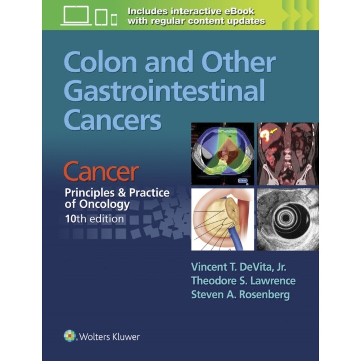 Colon and Other Gastrointestinal Cancers de Vincent T DeVita , Jr. MD