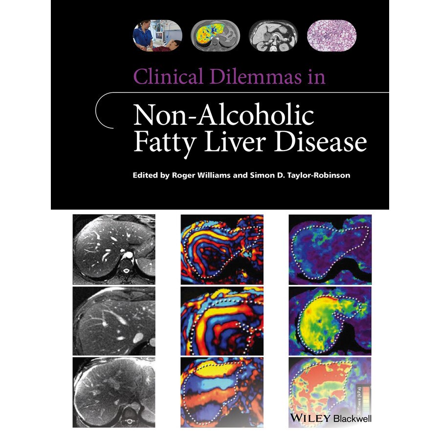 Clinical Dilemmas in Non/-/Alcoholic Fatty Liver Disease de Roger Williams
