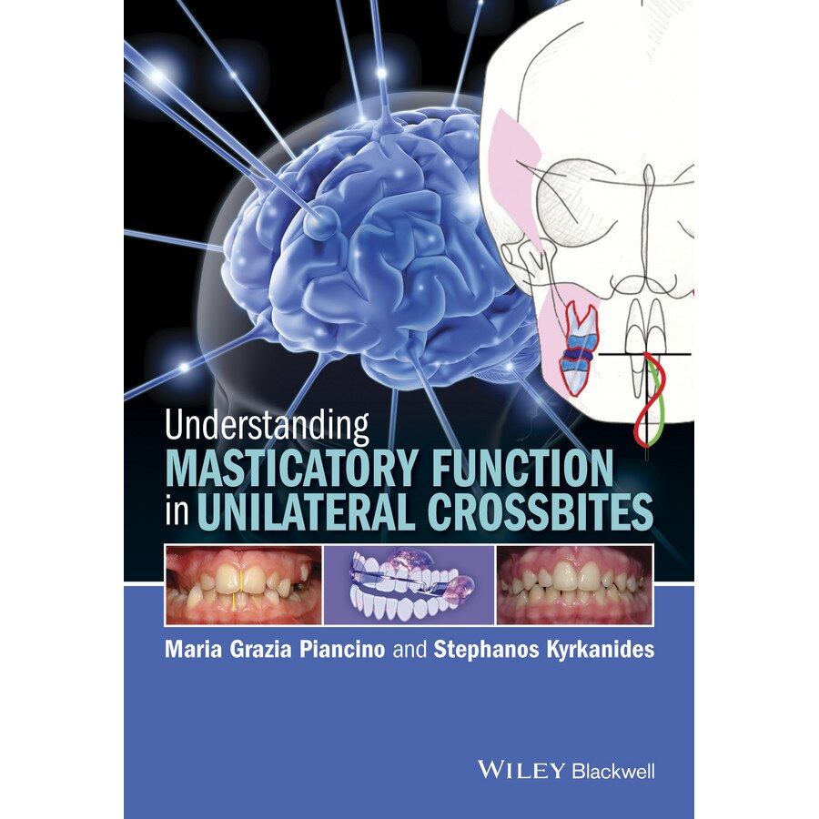 Understanding Masticatory Function in Unilateral Crossbites de Maria Grazia Piancino