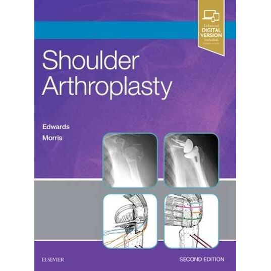Shoulder Arthroplasty de T. Bradley Edwards