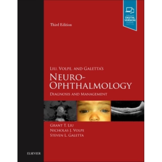 Liu, Volpe, and Galetta's Neuro-Ophthalmology de Grant T. Liu