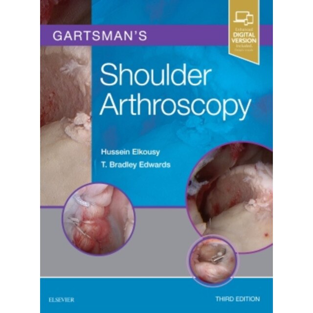 Gartsman's Shoulder Arthroscopy de Hussein Elkousy