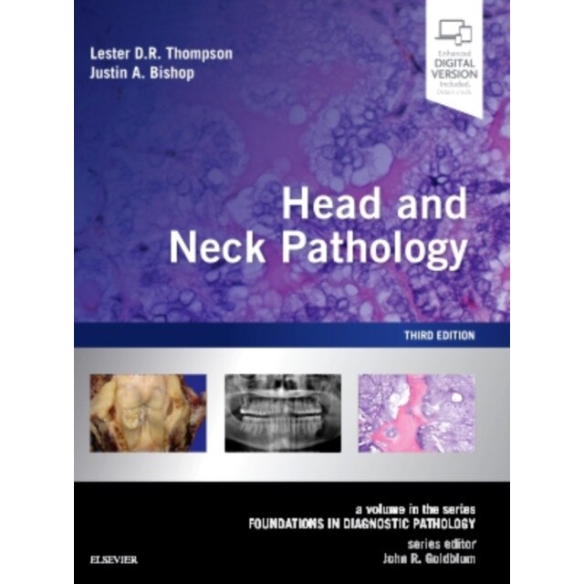 Head and Neck Pathology de Lester D. R. Thompson [Hardback]