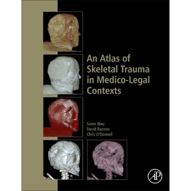 An Atlas of Skeletal Trauma in Medico-Legal Contexts de Soren Blau