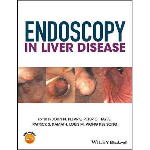 Endoscopy in Liver Disease de John N. Plevris