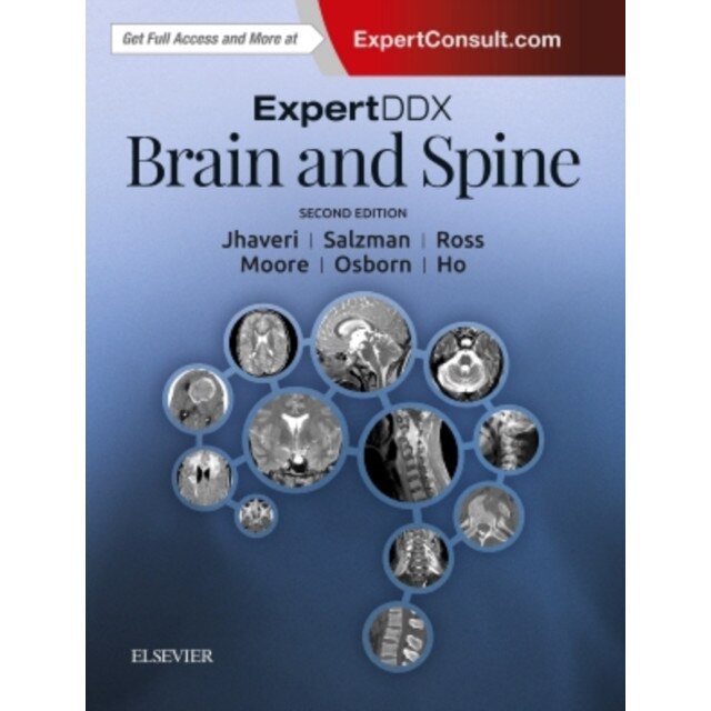 ExpertDDx: Brain and Spine de Miral D. Jhaveri