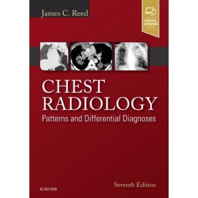 Chest Radiology de James C. Reed