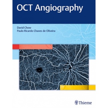OCT Angiography de David Chow OCT Angiography de David Chow