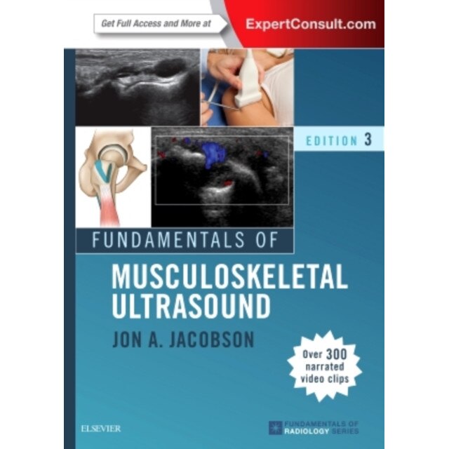 Fundamentals of Musculoskeletal Ultrasound de Jon A. Jacobson