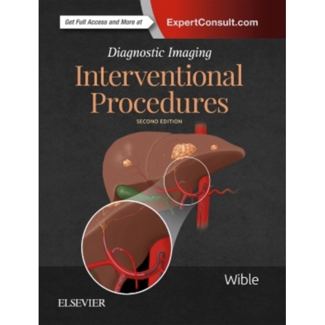 Diagnostic Imaging: Interventional Procedures de Brandt C. Wible