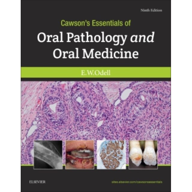 Cawson's Essentials of Oral Pathology and Oral Medicine de Edward W Odell