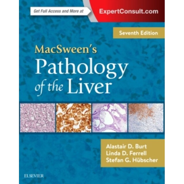 MacSween's Pathology of the Liver de Alastair D. Burt