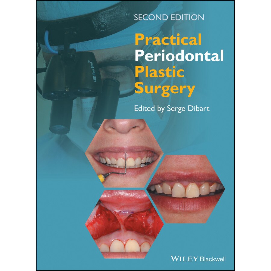 Practical Periodontal Plastic Surgery de Serge Dibart
