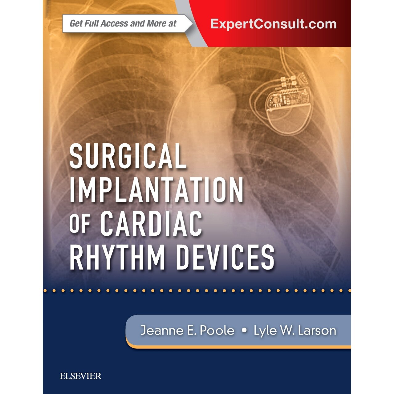Surgical Implantation of Cardiac Rhythm Devices de Jeanne Poole