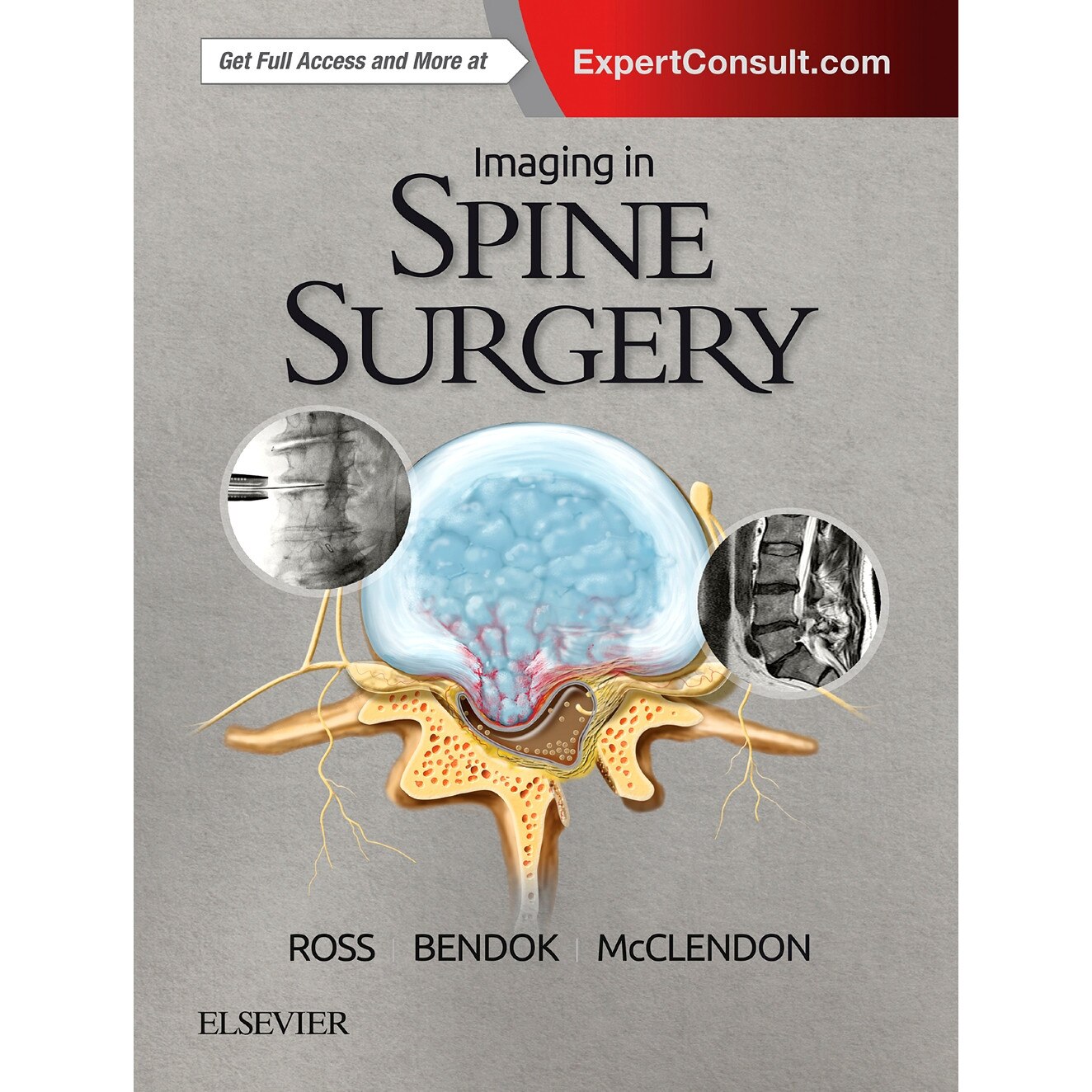 Imaging in Spine Surgery de Jeffrey S. Ross