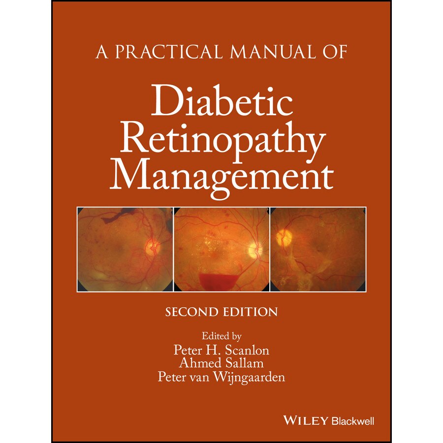 A Practical Manual of Diabetic Retinopathy Management de Peter H. Scanlon