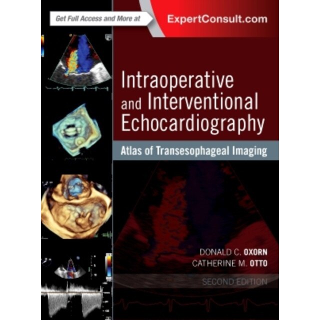 Intraoperative and Interventional Echocardiography de Donald Oxorn
