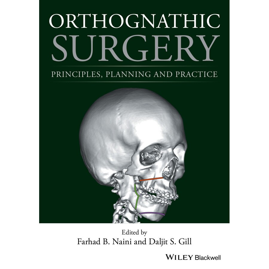 Orthognathic Surgery de Farhad B. Naini