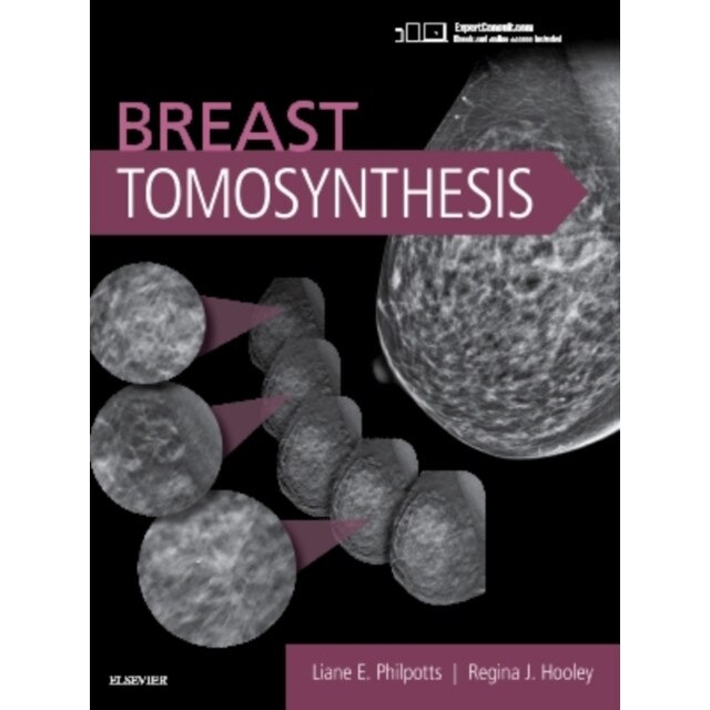 Breast Tomosynthesis de Liane E Philpotts