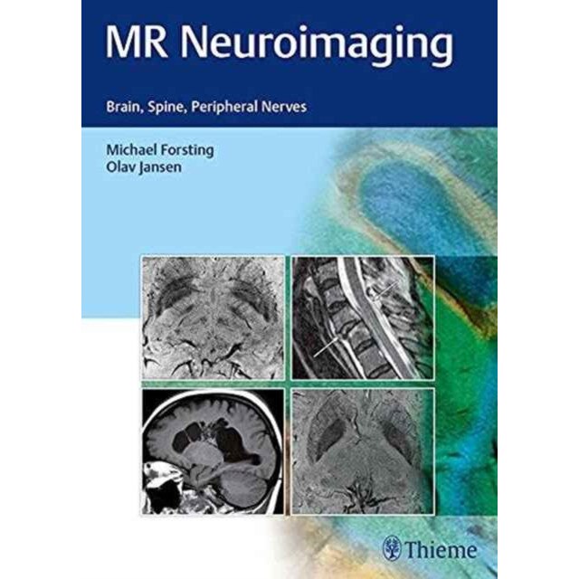 MR Neuroimaging de Olav Jansen